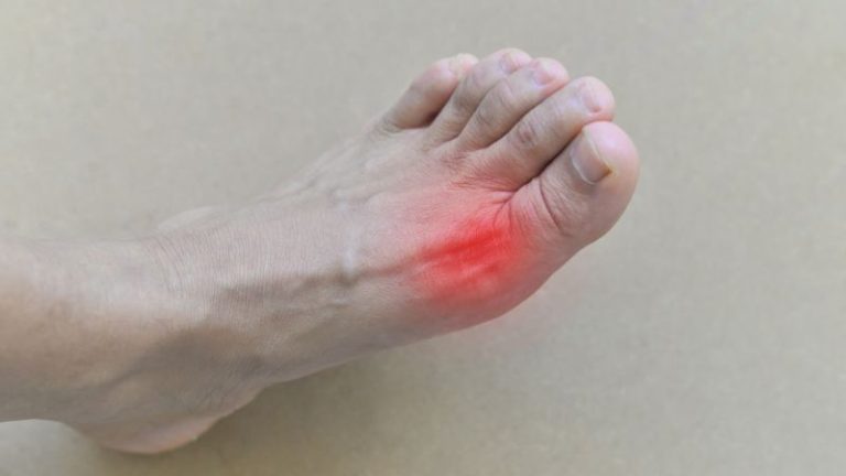 Is a Foot Spa Good For Gout?
